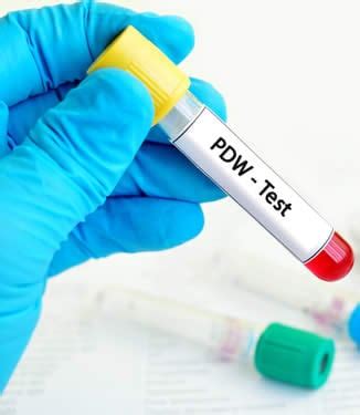 analisi sangue pdw.